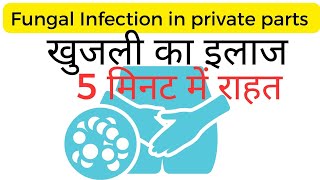 Fungal infection in private parts home remedy in Hindi [upl. by Ecilayram410]