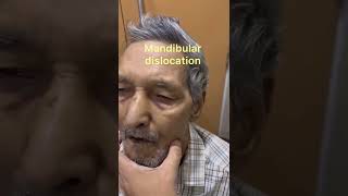 Temporomandibular TMJJoint Dislocation Reduction Technique Mandibular dislocationJaw dislocation [upl. by Uno]