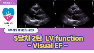 Visual ejection fraction  EF eyeball estimation echocardiography 심장초음파 heart echo view [upl. by Jennette872]