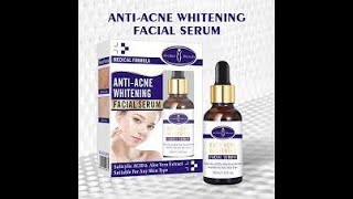 Aichun Beauty Anti Acne Whitening Facial Serum  AntiAcne Whitening Serum  Product Review [upl. by Wilkey]