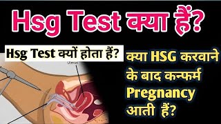 Kya HSG Test ke Baad Confirm Pregnancy Hoti Hai  helpbyreetu [upl. by Daney859]