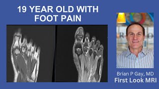 19 year old with foot pain [upl. by Modnar]