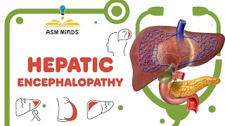 Hepatic Encephalopathy [upl. by Cindy]