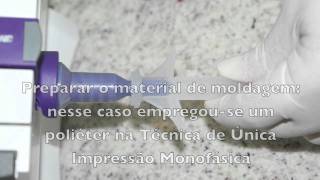 Moldagem aberta para implantes [upl. by Cannell]