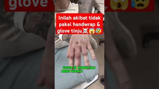 Jgn coba² gk pake glove klo GK mau kek gini ☠️😰 boxing boxingskill fight mma bangghalyh [upl. by Idyak]