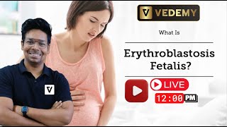 Erythroblastosis Fetalis  Detailed Explanation  Virendra Singh  CSIR  GATE  DBT  ICMR  CUET [upl. by Sadnac]