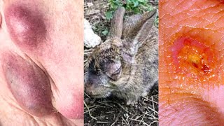 WHAT IS TULAREMIA SYMPTOMS CAUSES TREATMENT [upl. by Llerol]