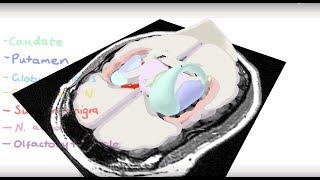 Basal Ganglia 3D Tour [upl. by Haida932]