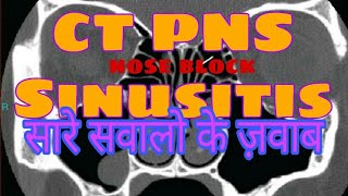 CT Scan PNS Sinusitis in Hindi  by Radiographer Guruji [upl. by Bascio]