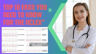 Top 10 EKGs You Need to Know for the NCLEXquot [upl. by Aicirtam]