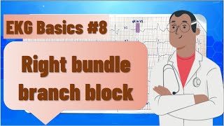 ECG basics  right bundle branch block RBBB  ECG findings and examples clinical significance [upl. by Juan]