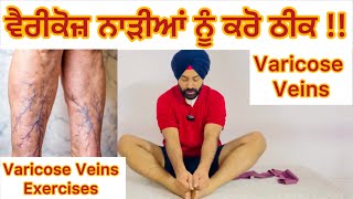 ਵੈਰੀਕੋਜ਼ ਨਾੜੀਆਂ ਨੂੰ ਕਰੋ ਠੀਕ  Varicose Veins Treatment Varicose Veins Relief Exercises at Home 🏡 [upl. by Clea]