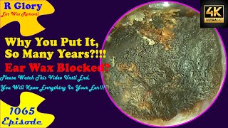 Why You Put It So Many Years  New Video Ear Wax Removal 1065 earwax earwaxremoval [upl. by Witt]