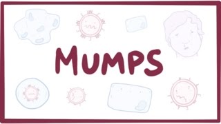 Mumps  symptoms diagnosis treatment pathology [upl. by Vonny564]