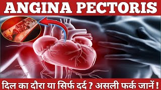 ❤️‍🩹angina pectoris in hindi  seene mein dard kyon hota hai   chest pain ho to kya karen  1mg [upl. by Normi997]