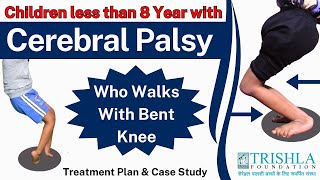 Young Child with Cerebral Palsy amp Bent Knee Successfully Walks  Part 3  Trishla foundation [upl. by Perry238]