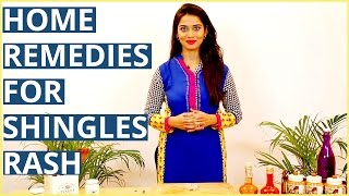 3 Ayurvedic Home Remedies For SHINGLES RASH TREATMENTS [upl. by Lyns654]