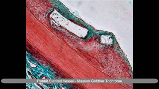 Laser Microtomy  Histological stains of undecalcified hard tissue and implanted tissue [upl. by Nij]