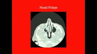 Nasal Cavity  CRASH Medical Review Series [upl. by Lizabeth]