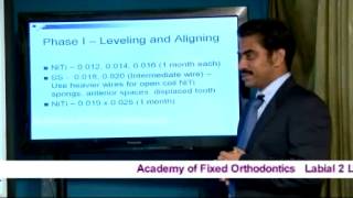 Orthodontic Mechanotherapy  Wire Sequence and Standard Operating Protocol [upl. by Melba165]