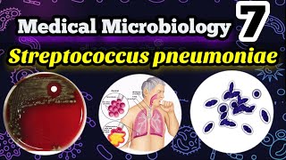 Streptococcus pneumoniae شرح بالعربي البكتيريا المسببه لإلتهاب الرئوي والجيوب الأنفية والأذن الوسطي [upl. by Attegroeg647]