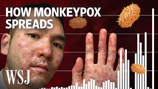 Why Monkeypox Is a Global Health Threat  WSJ [upl. by Saravat]