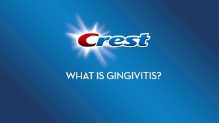 What is Gingivitis  Crest [upl. by Anak]