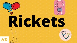 Rickets Causes Signs and Symptoms Diagnosis and Treatment [upl. by Ellissa]