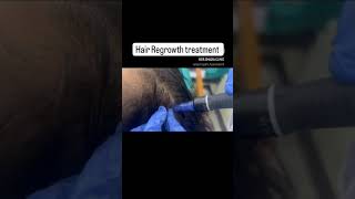 Hair Regrowth treatment haircare drshazia hairgrowth hairgrowthtips [upl. by Derna494]