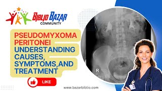 Pseudomyxoma Peritonei Explained Symptoms Treatment and Care 🏥  Rare Abdominal Condition [upl. by Nivra81]