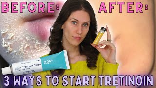 3 Ways To Start Tretinoin Without Irritation  How To Start Retinoids Without Irritation amp Peeling [upl. by Kokoruda]