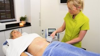 NonSurgical Liposuction and Body Contouring  Exilis Elite  Award Winning Treatment [upl. by Colin]