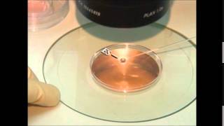 vitrification of embryos and oocytes [upl. by Thorndike]