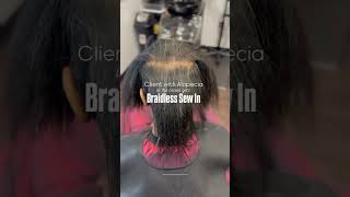 Braidless Sew In Weave for client with Alopecia [upl. by Llennej]