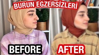 1 HAFTA BOYUNCA BURUN KÜÇÜLTME EGZERSİZLERİNİ DENEDİM  İNANILMAZ SONUÇ 😮👃🏻 [upl. by Mir]