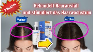 Trichomist Forte Haarausfallbehandlung Ist es gut Anwendung Preis wo kaufen [upl. by Desireah689]