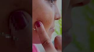 Dark spots and pigmentation removal challenge  get spotless skin shorts youtube skincare glowup [upl. by Platt]