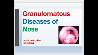 Granulomatous Diseases of Nose Dr Krishna Koirala Dr Krishnas ENT Lectures [upl. by Iggy831]