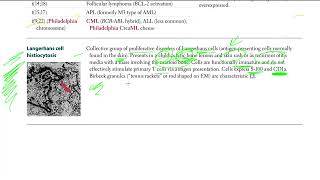 45 Langerhans cell histiocytosis [upl. by Anilak407]