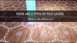 Why Are There Different Types of Pico Laser  Dr Kenneth Thean [upl. by Keverian]