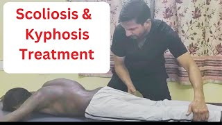 Sపార్శ్వగూని మరియు కైఫోసిస్ చికిత్సscoliosis amp Kyphosis treated by Indian chiropractor 7023645760 [upl. by Nylyaj]