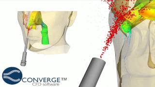 Simulation of Nasal Drug Delivery Systems in CONVERGE 12 [upl. by Siravaj199]