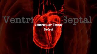 Normal Heart Sounds vs Ventricular Septal Defect Murmur [upl. by Yecats]