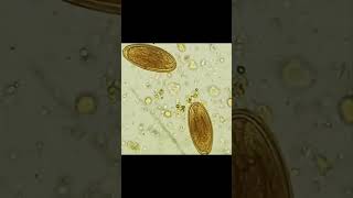 Parasitology  Identify [upl. by Aklam958]