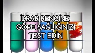 İdrar Rengine Göre Sağlığınızı Test Edin [upl. by Labaw265]