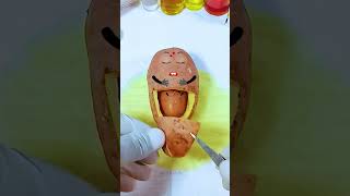 Potato has a Baby Need Emergency Surgery jidoodle fruitsurgery foodsurgery [upl. by Novoj]