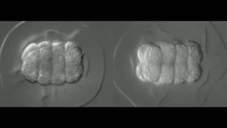 Developing bryozoan embryos animalvegetal views [upl. by Corrie]