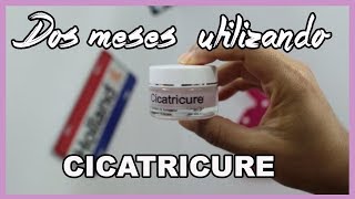 Crema Cicatricure contorno de ojos ¿Funciona de verdad [upl. by Eadwina]