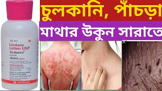 Scaboma Lotion  Use Dose Benefits Side effects In Bengali চুলকানি পাঁচড়া অব্যর্থ [upl. by Tdnarb]