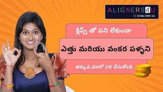 Best and Low cost aligners in hyderabad aligners youtubeshorts dental trending shorts telugu [upl. by Brew]